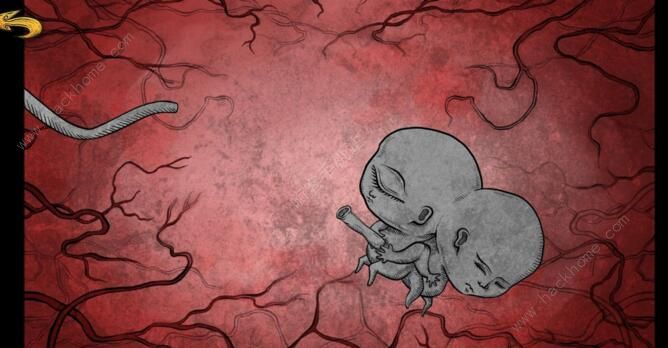 人生画廊攻略大全 全章节图文通关攻略[视频][多图]图片3