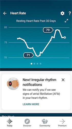 Fitbit手环